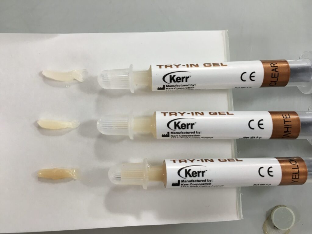 歯の接着剤 ドラッグストアで購入!緊急応急処置ガイド